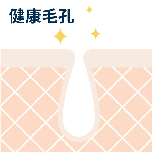 黑頭粉刺