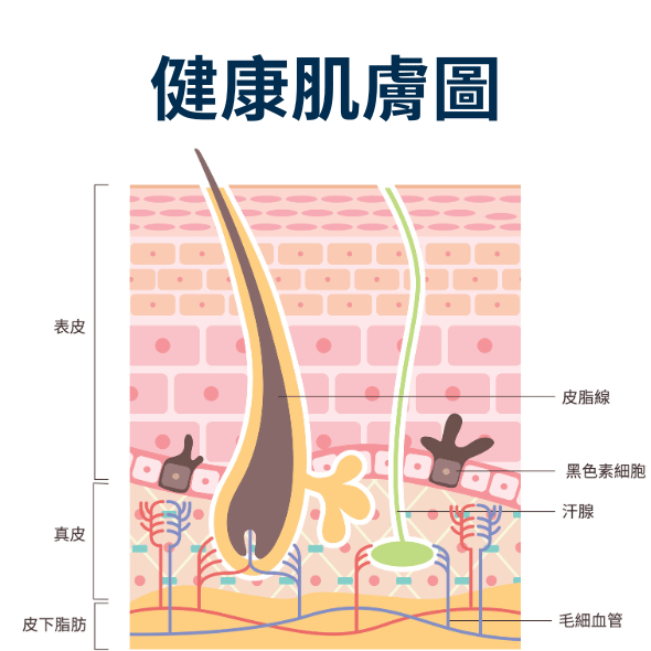 黑頭粉刺