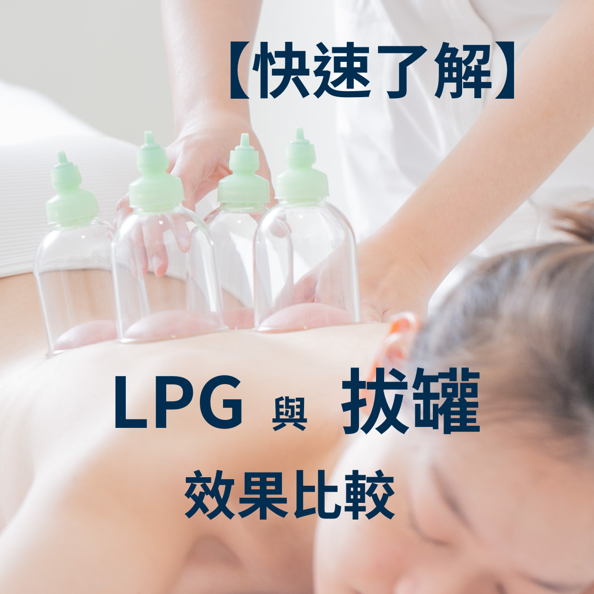 lpg體雕