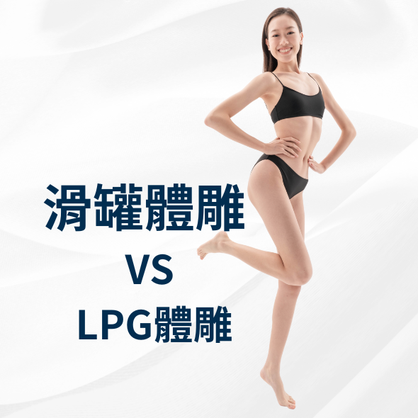 lpg體雕