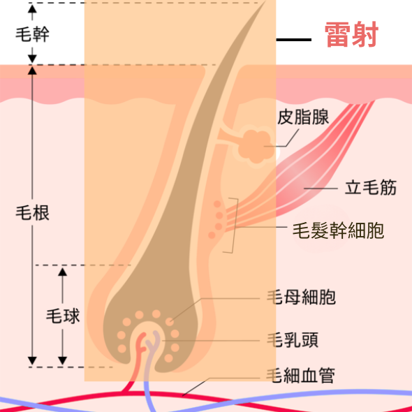 永久除毛