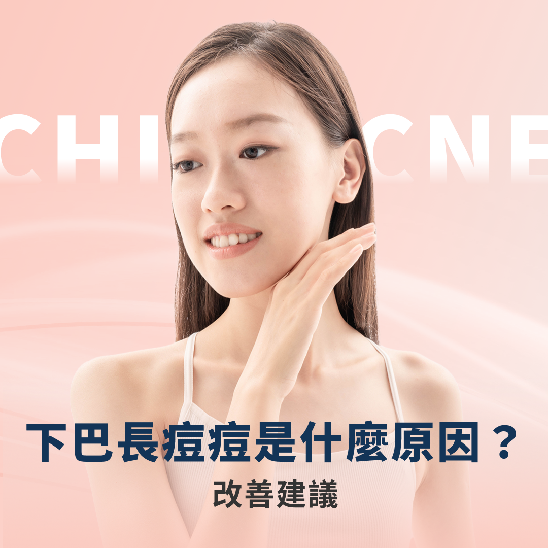 下巴長痘痘 下巴長痘痘
