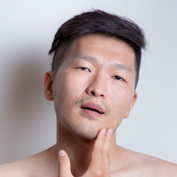 下巴長痘痘 下巴長痘痘