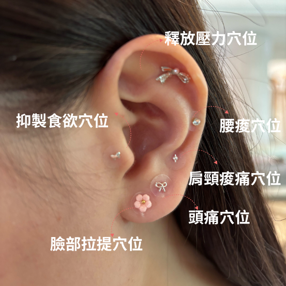 耳穴貼 耳穴貼