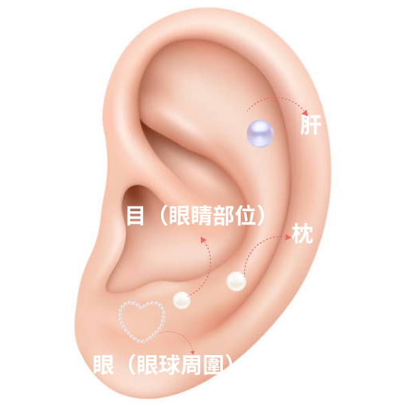 耳穴貼 耳穴貼
