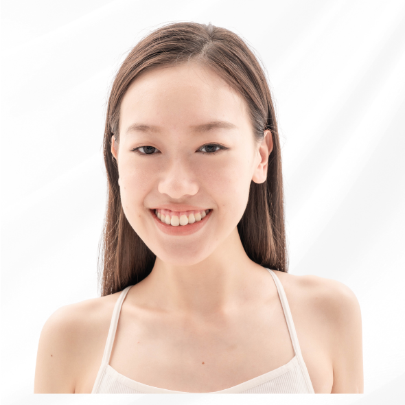 額頭長痘痘