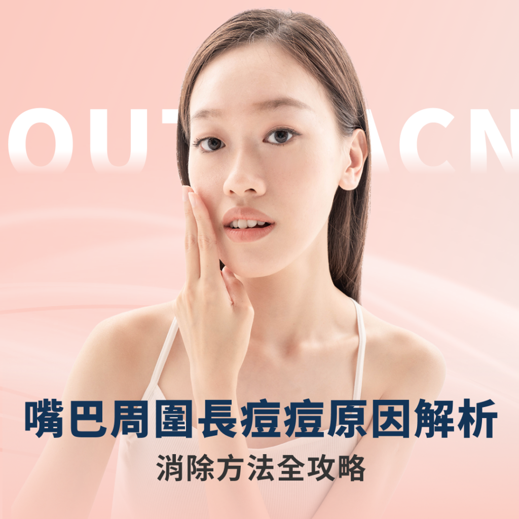 嘴巴周圍長痘痘