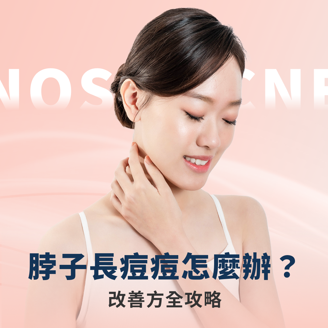 脖子長痘痘 脖子長痘痘