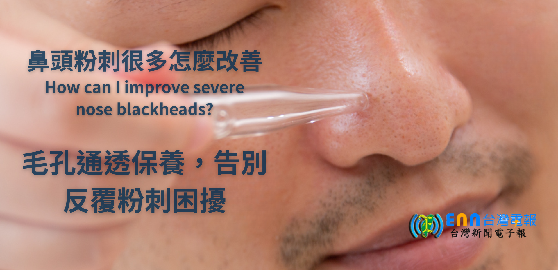 鼻頭粉刺很多怎麼改善
