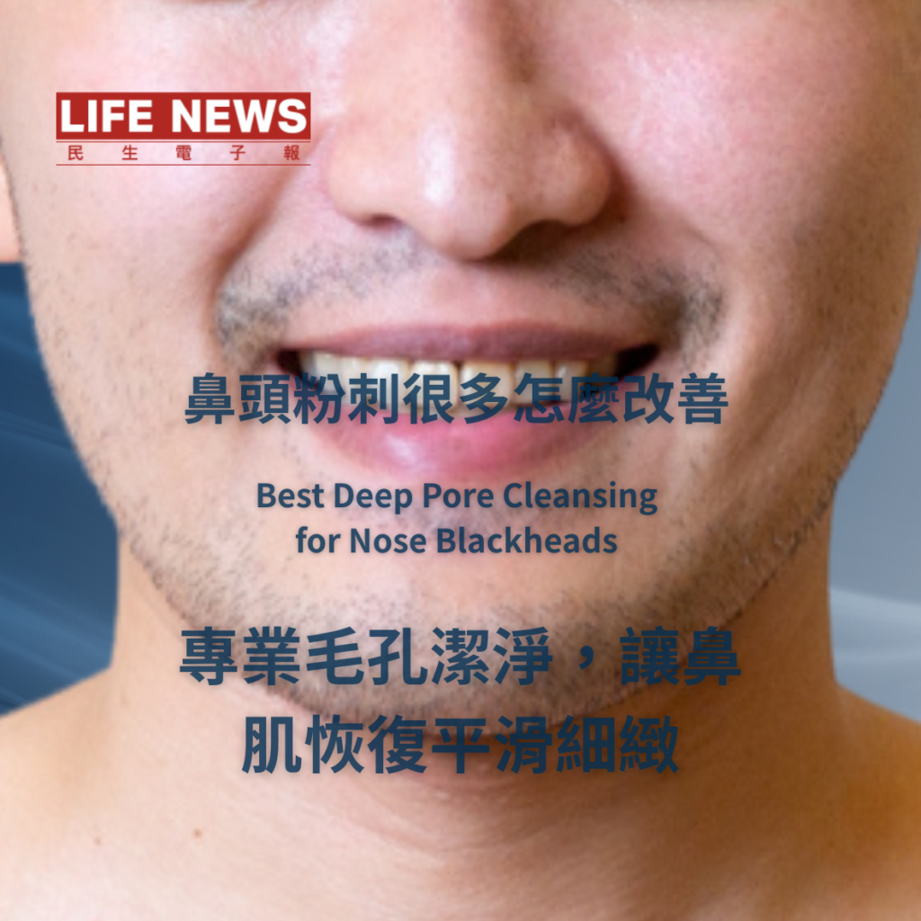 鼻頭粉刺深層清潔推薦