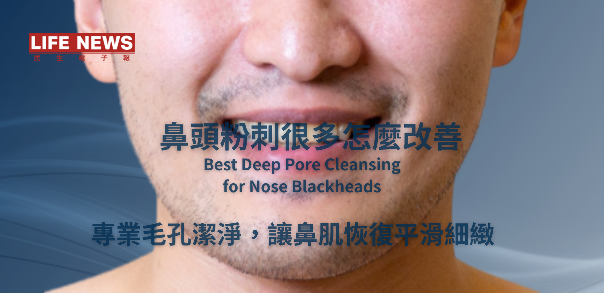 鼻頭粉刺深層清潔推薦